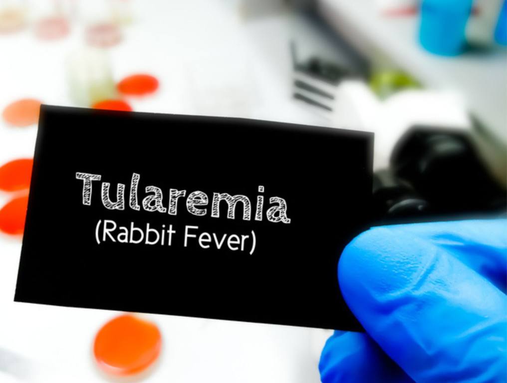 Tularemia medical term on a card in doctor hand. Medical conceptual image. Rabbit fever. Francisella tularensis